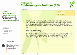 Netzwerk Epidermolysis bullosa
